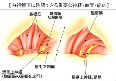 実際の手術手技