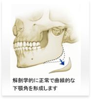 エラ（エラ削り）