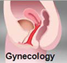 インティマレーザー