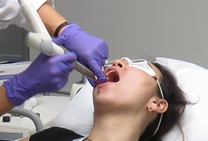 スマイルリフト