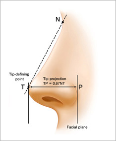 理想的な鼻尖形態