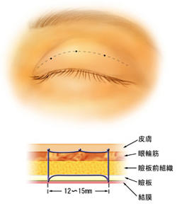 3点固定法の詳細