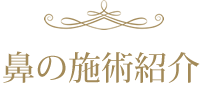 施術紹介